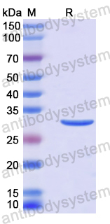 Recombinant Human NPHP4 Protein, N-His