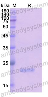 Recombinant Human KDM4A Protein, N-His