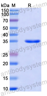Recombinant Human SS18L1 Protein, N-GST & C-His