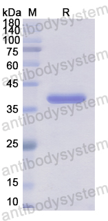 Recombinant Human ATP2C2 Protein, N-GST