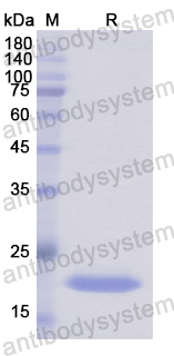 Recombinant Human GADD45B Protein, N-His