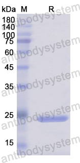 Recombinant Human DUSP11 Protein, N-His