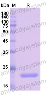 Recombinant Human PDCD6 Protein, N-His