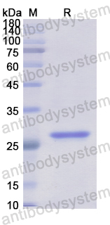 Recombinant Human ALOX12B Protein, N-His