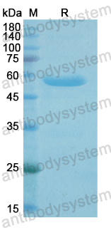 Recombinant Human MACROH2A1 Protein, N-GST