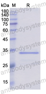 Recombinant Human FLNB Protein, N-His