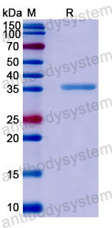 Recombinant Human NDUFS6 Protein, N-GST & C-His