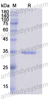 Recombinant Human CS Protein, N-His