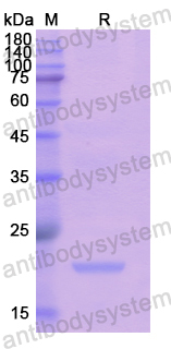 Recombinant Human KATNA1 Protein, N-His