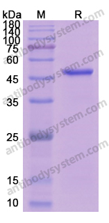 Recombinant Human ERN1 Protein, N-His