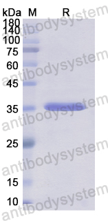 Recombinant Human EED Protein, N-His