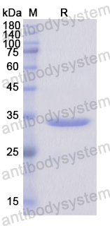 Recombinant Human SF3B1 Protein, N-His