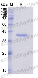 Recombinant Human RPS6KA5 Protein, N-His