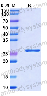 Recombinant Human LYPLA1 Protein, N-His