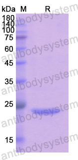 Recombinant Human PRDM1 Protein, N-His