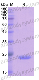 Recombinant Human UPK3A Protein, N-His