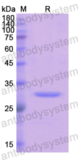 Recombinant Human FCN3 Protein, N-His