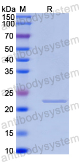Recombinant Human OFD1 Protein, N-His-SUMO