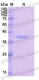 Recombinant Human ADAP1 Protein, N-His