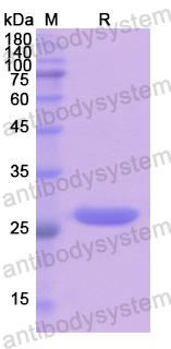 Recombinant Human NUP155 Protein, N-His