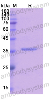 Recombinant Human TRPA1 Protein, N-His