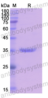 Recombinant Human RNASEH2A Protein, N-His