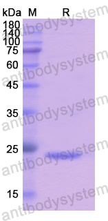 Recombinant Human CDC123 Protein, N-His