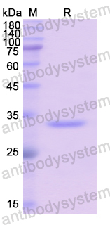 Recombinant Human BCAR3 Protein, N-His