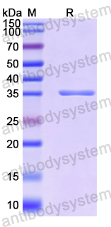 Recombinant Human BCAR3 Protein, N-His
