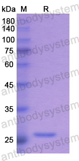 Recombinant Human RPP40 Protein, N-His