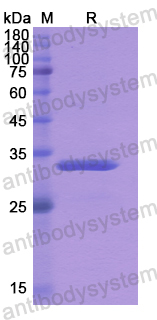 Recombinant Human CBR3 Protein, N-His