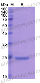 Recombinant Human CNMD Protein, N-His