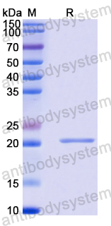 Recombinant Human KLF7 Protein, N-His