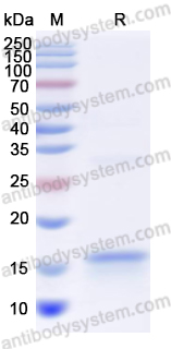 Recombinant Human UPK1B Protein, N-His