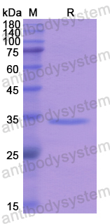 Recombinant Human AP1G2 Protein, N-His