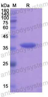 Recombinant Human MMP23B Protein, N-His