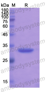 Recombinant Human DGAT1 Protein, N-His