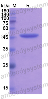 Recombinant Human SOAT2 Protein, N-His