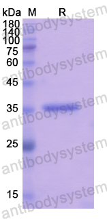 Recombinant Human RGS9 Protein, N-His