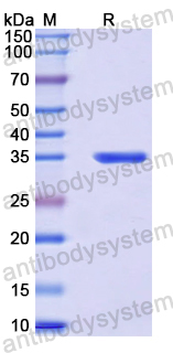Recombinant Human CABYR Protein, N-GST & C-His