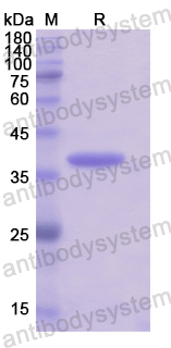 Recombinant Human KRT33A Protein, N-His