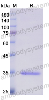 Recombinant Human SCGN Protein, N-His