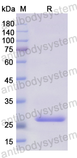 Recombinant Human STC2 Protein, N-His