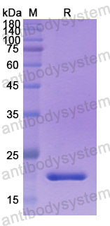 Recombinant Human PDE5A Protein, N-His