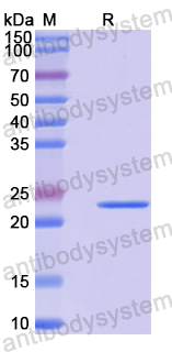 Recombinant Human SLC22A5 Protein, N-His-SUMO