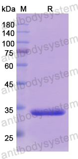 Recombinant Human DDAH1 Protein, N-His