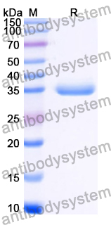 Recombinant Human STK10 Protein, N-His