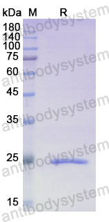 Recombinant Human TPPP Protein, N-His