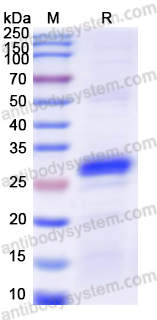 Recombinant Human SLIT2 Protein, N-His