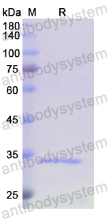 Recombinant Human TOMM70 Protein, N-His